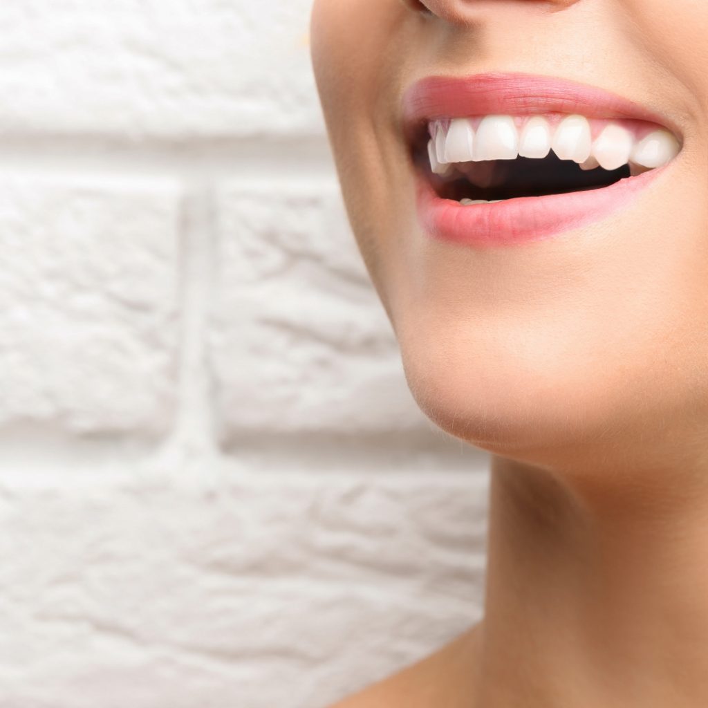 dental bonding adamsville